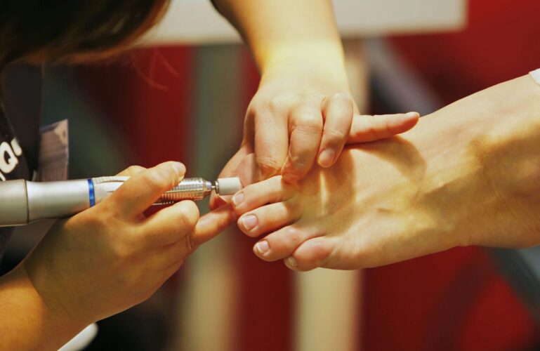 Pedicure